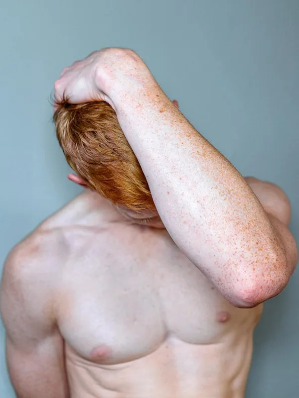 Personne nue du torse, cheveux roux courts, bras levé derrière la tête, peau claire avec taches de rousseur, fond gris uni